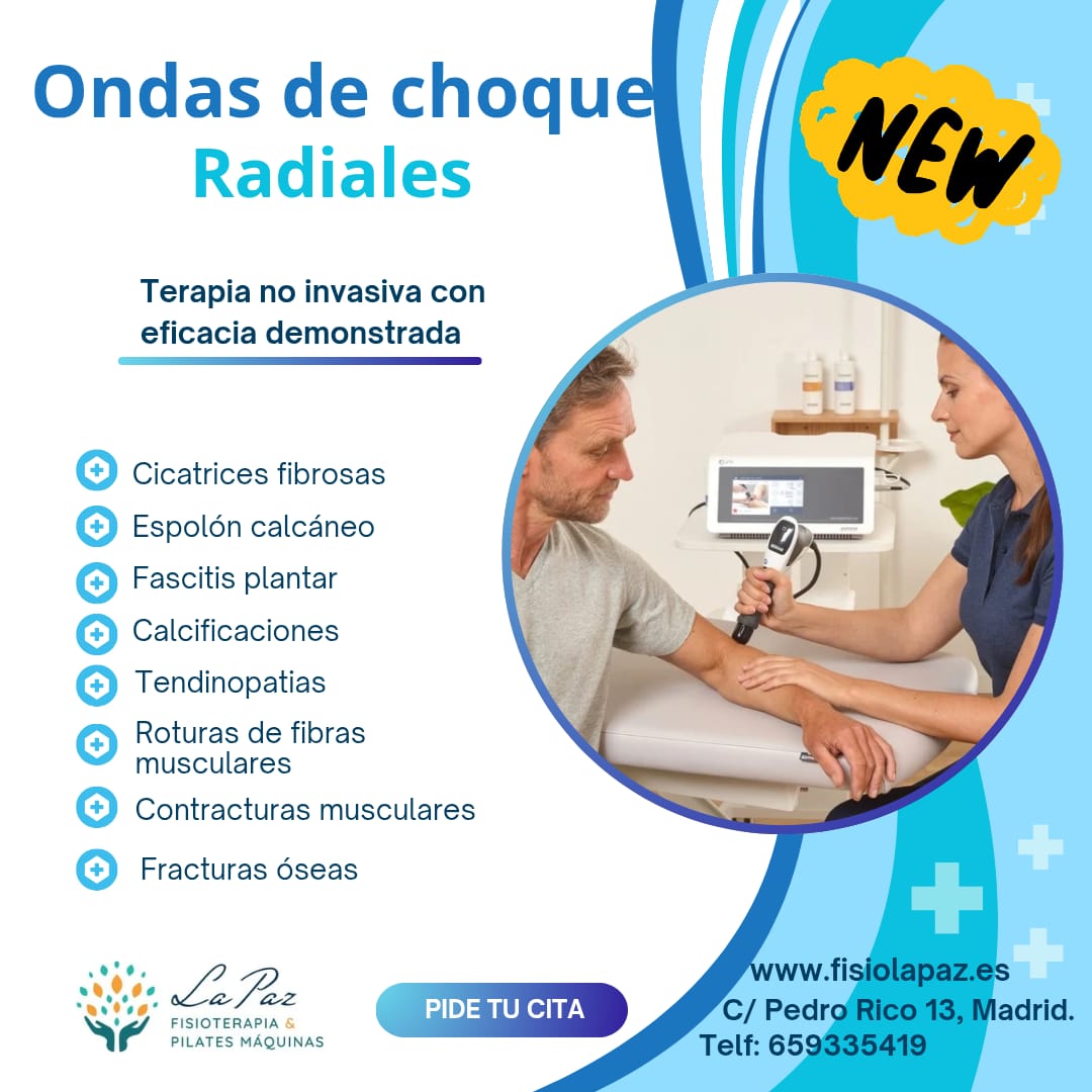 Ondas choque radiales
